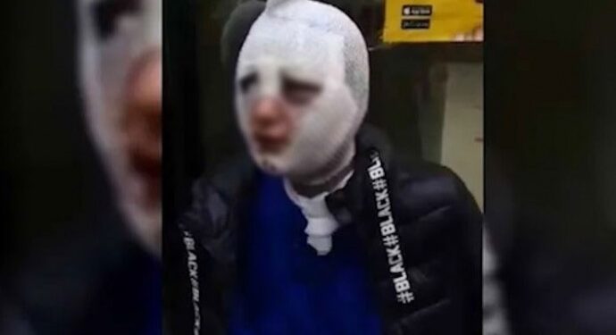 Kadını katletmeye çalışan Erkmen’e hapis cezası